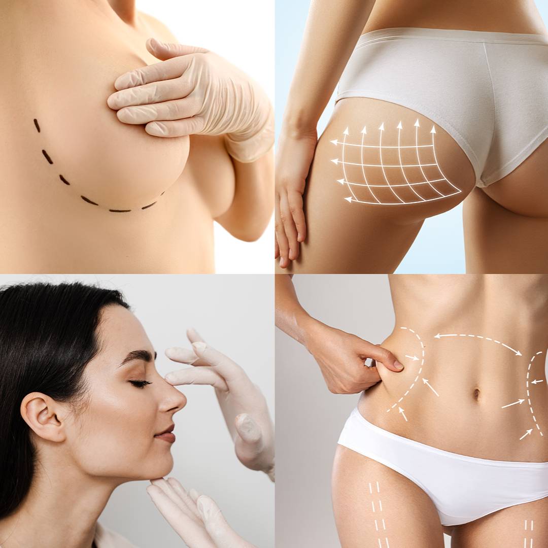 What Is Plastic Aesthetic Surgery?