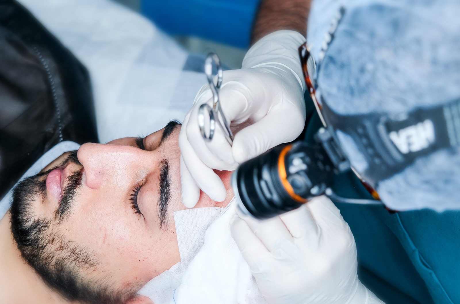 What Is a Hair Transplant?