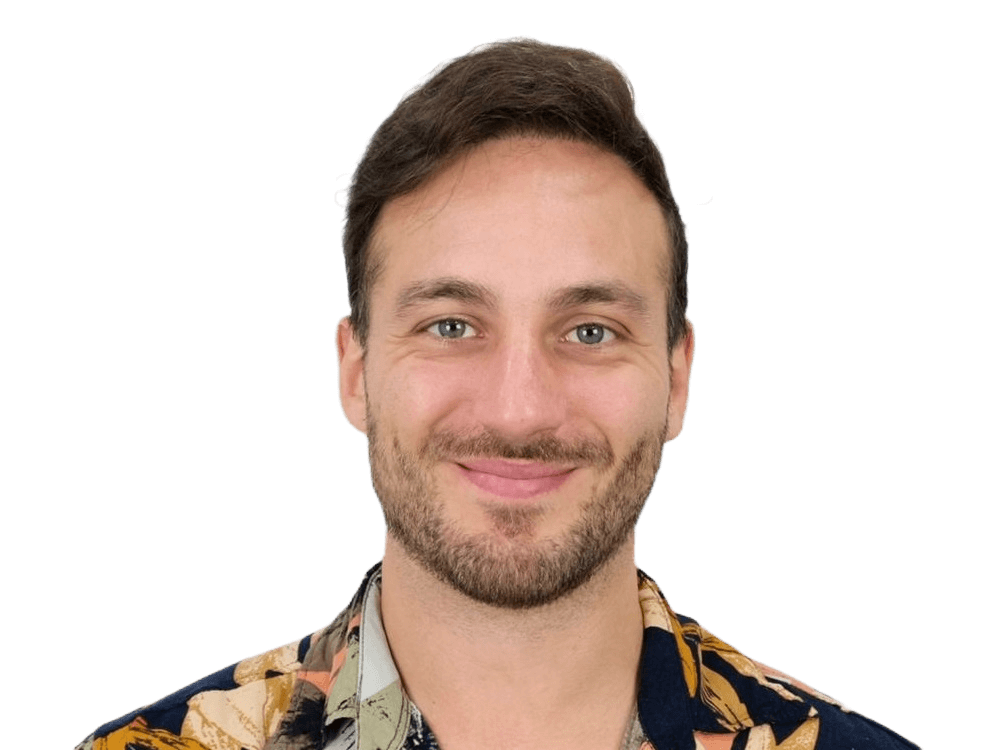 Hair Transplant Result