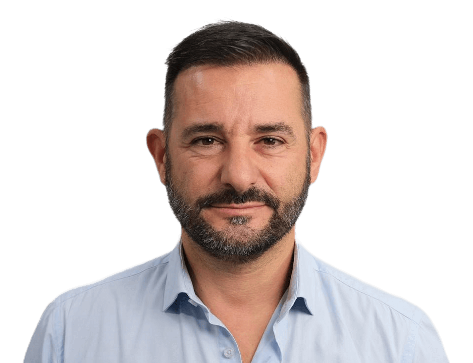 Hair Transplant Result