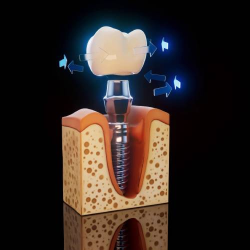 Osseointegration Process