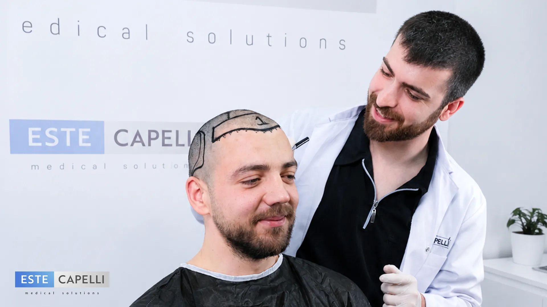 Trapianto capelli Turchia Estecapelli - clinica Istanbul risultati naturali