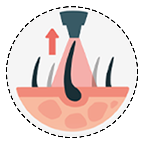 1. Harvesting Hair Follicles