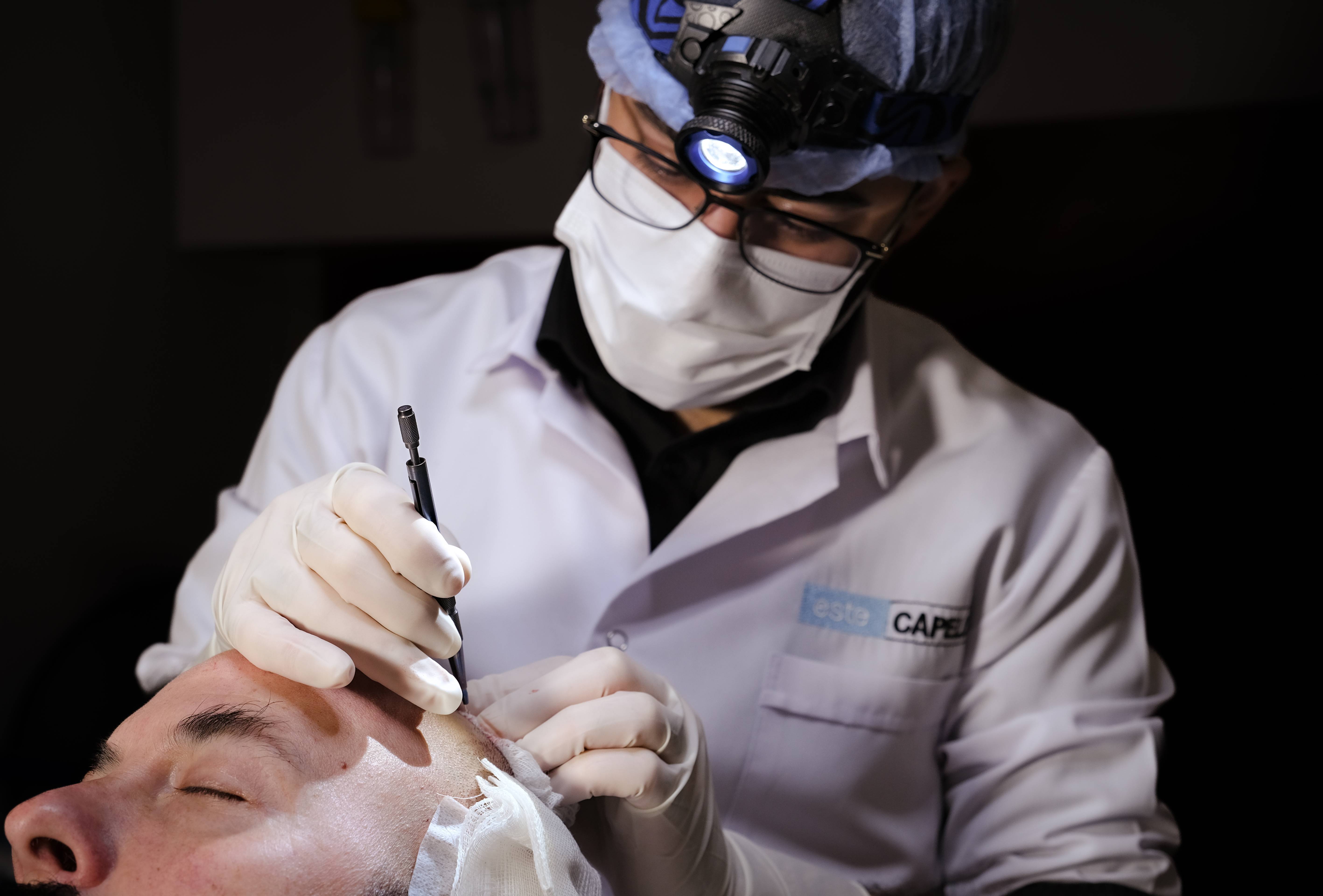 Sapphire FUE Hair Transplant