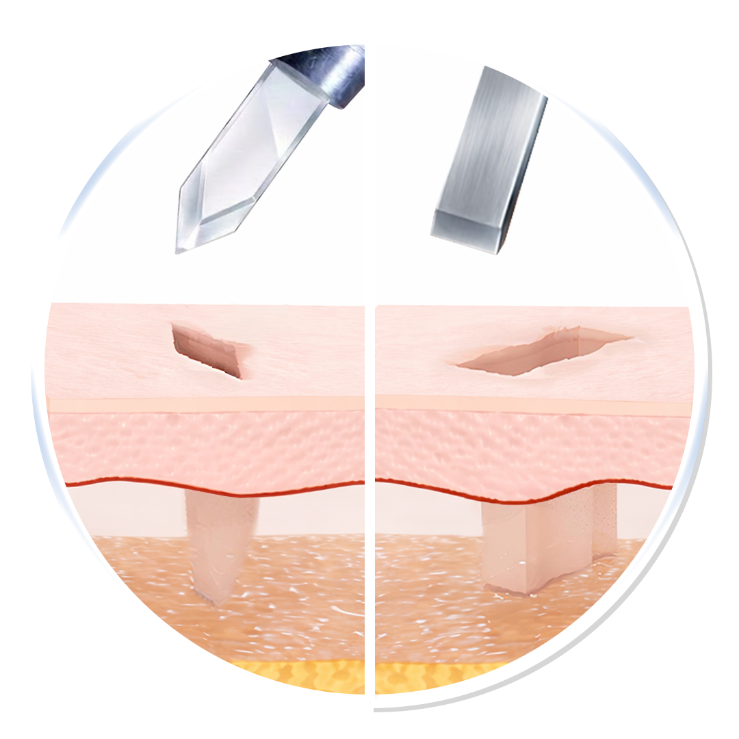 Sharp and Smooth Channels