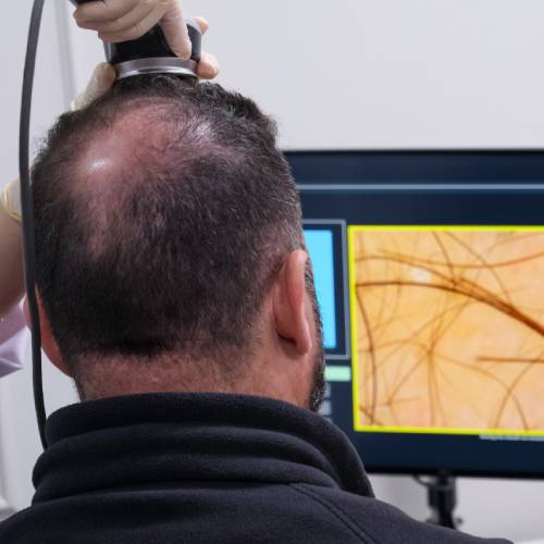 Digital Trichoscopic Scanning