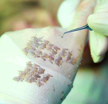 Stage 3: Donor Graft Extraction