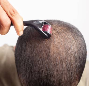 Stage 1: Microneedling And Nourishing Serum Application 