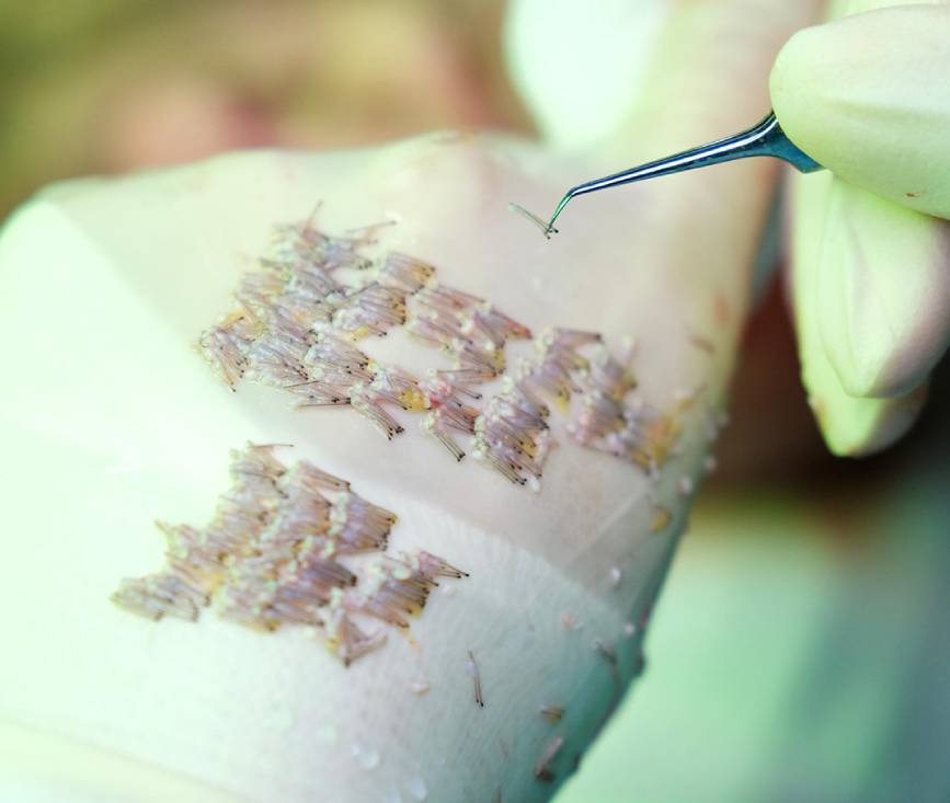 Stage 3: Donor Graft Extraction