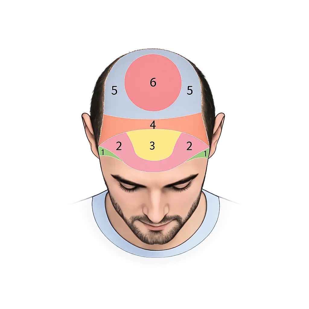 Scalp zones
