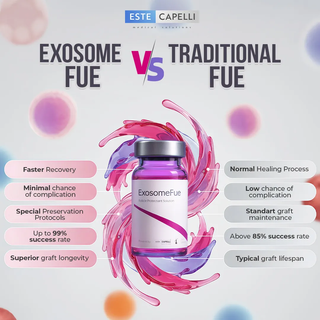 The Most Important Advantages of Exosome FUE