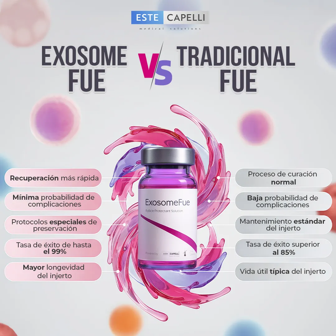 Principales ventajas de Exosome FUE