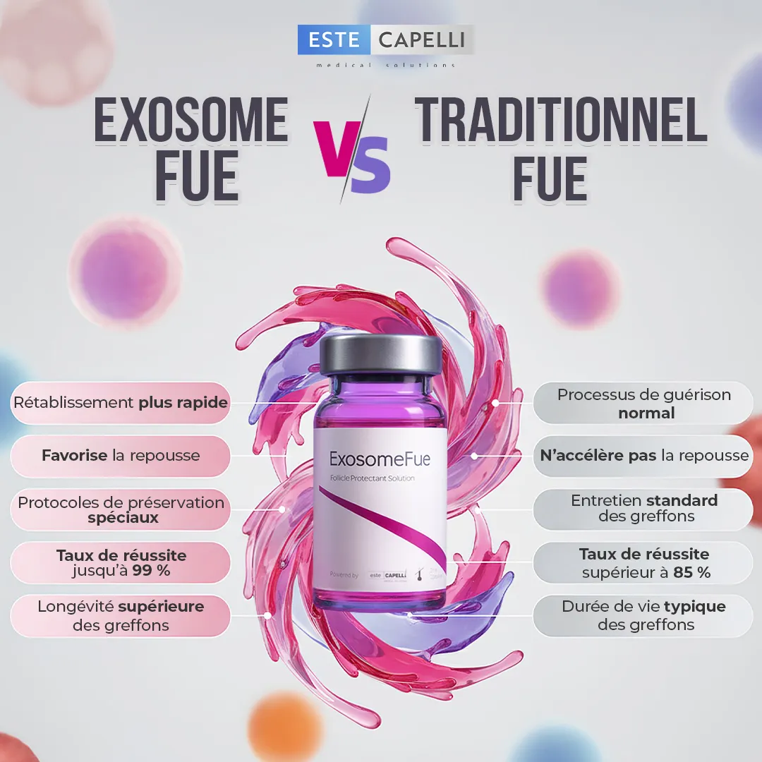 Les principaux avantages de l’Exosome FUE