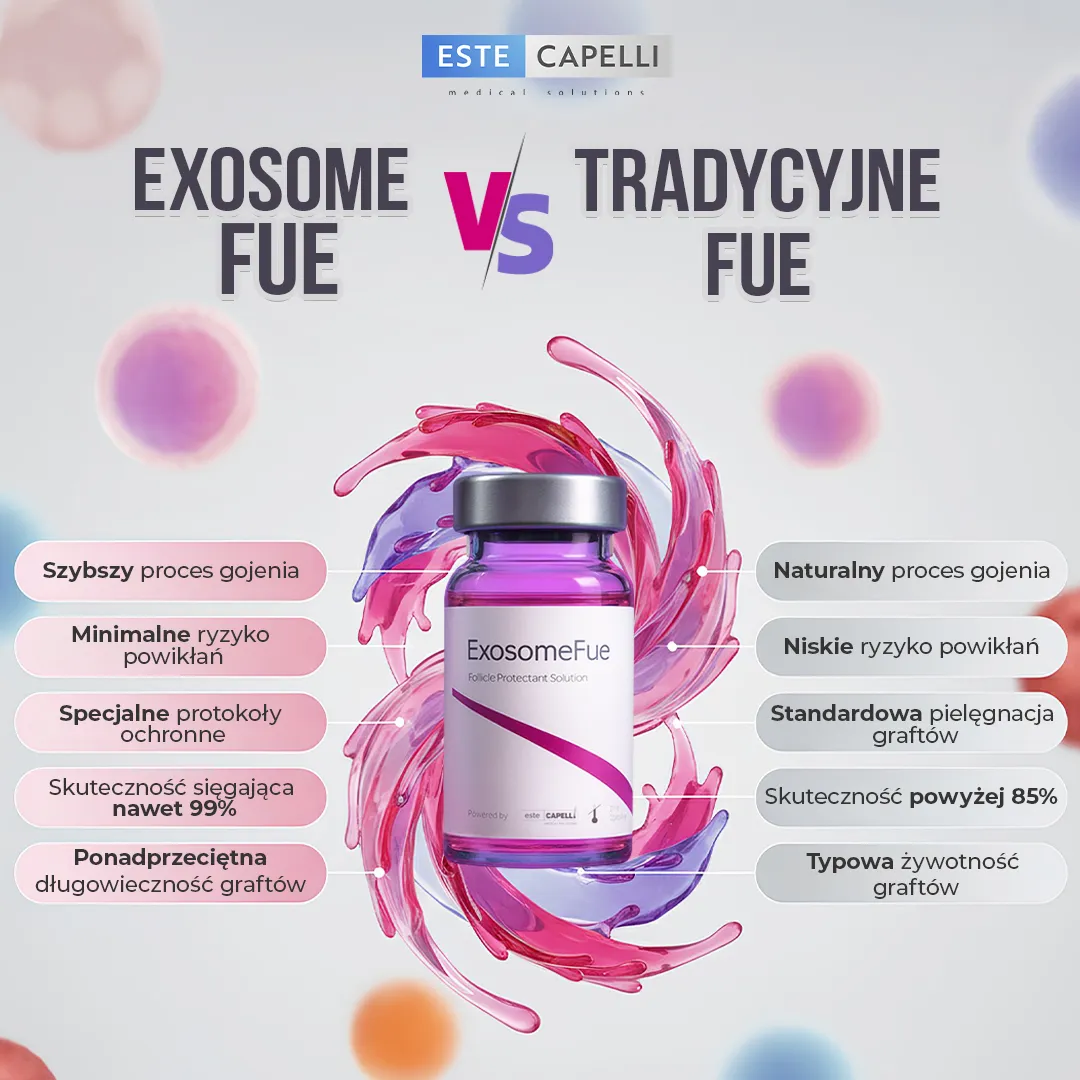 Najważniejsze zalety Exosome FUE