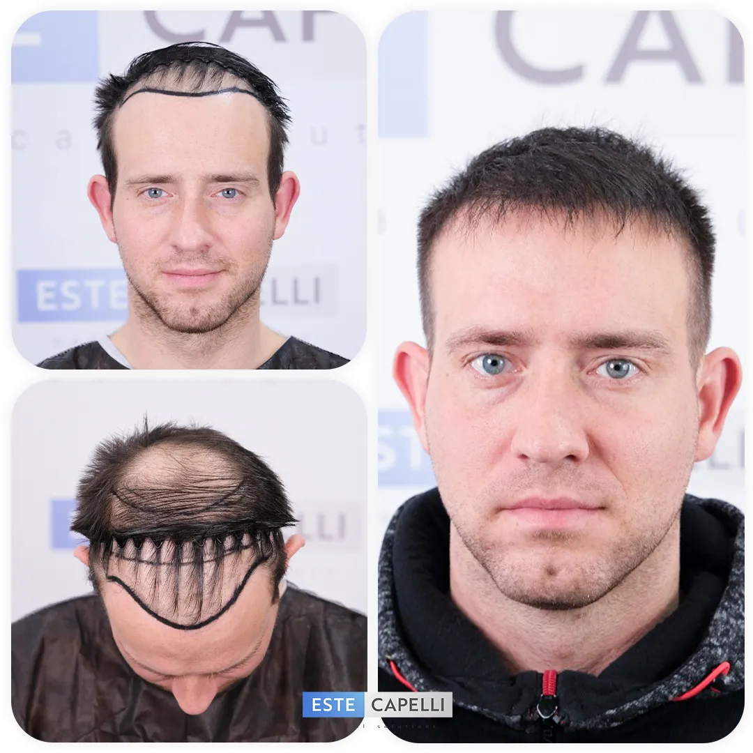 Before and after result