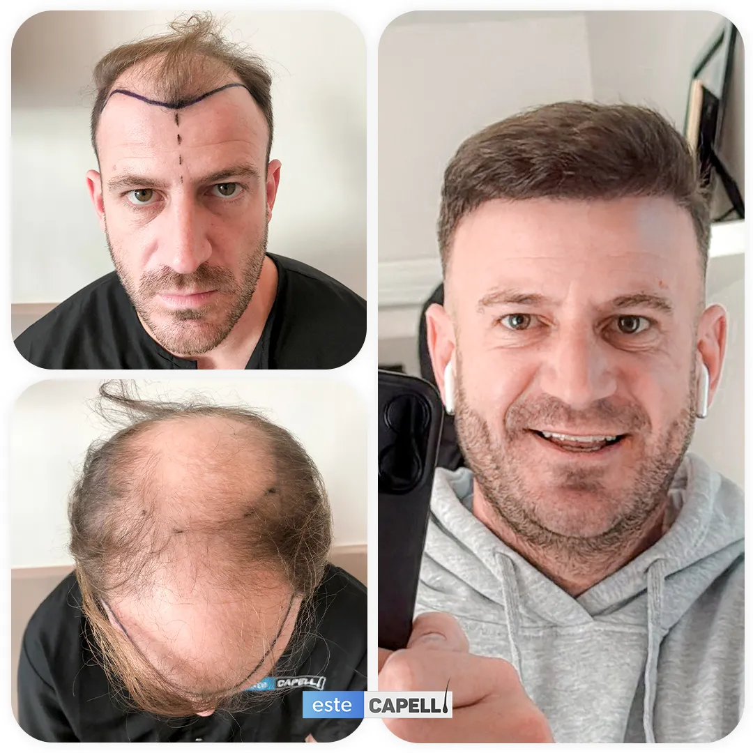 Before and after result