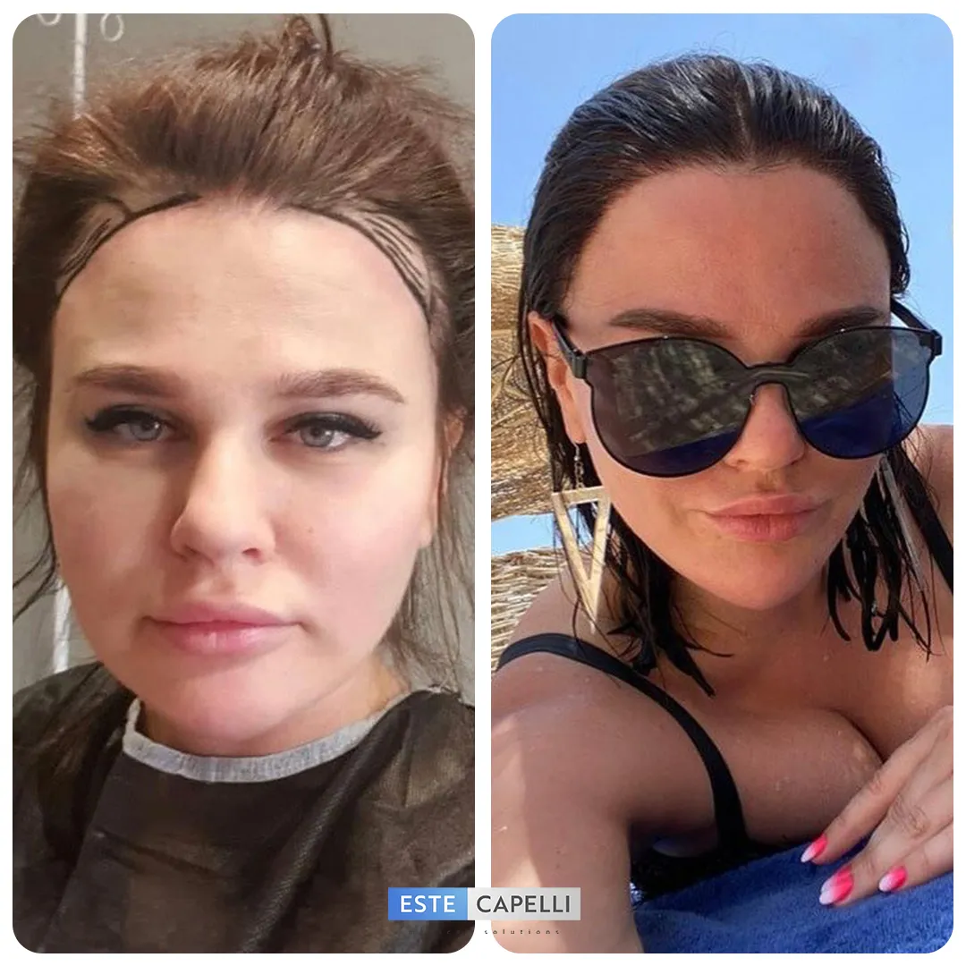 Before and after result