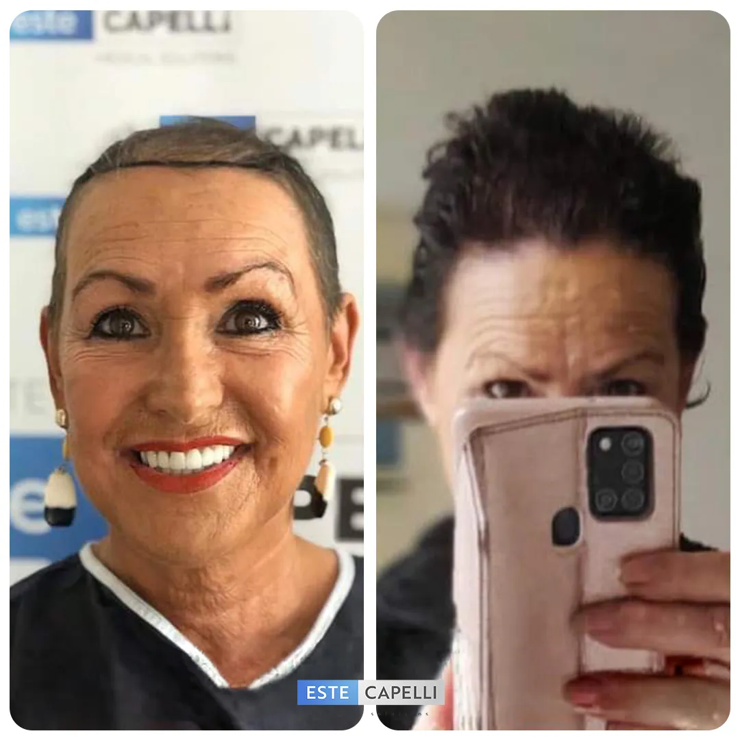 Before and after result