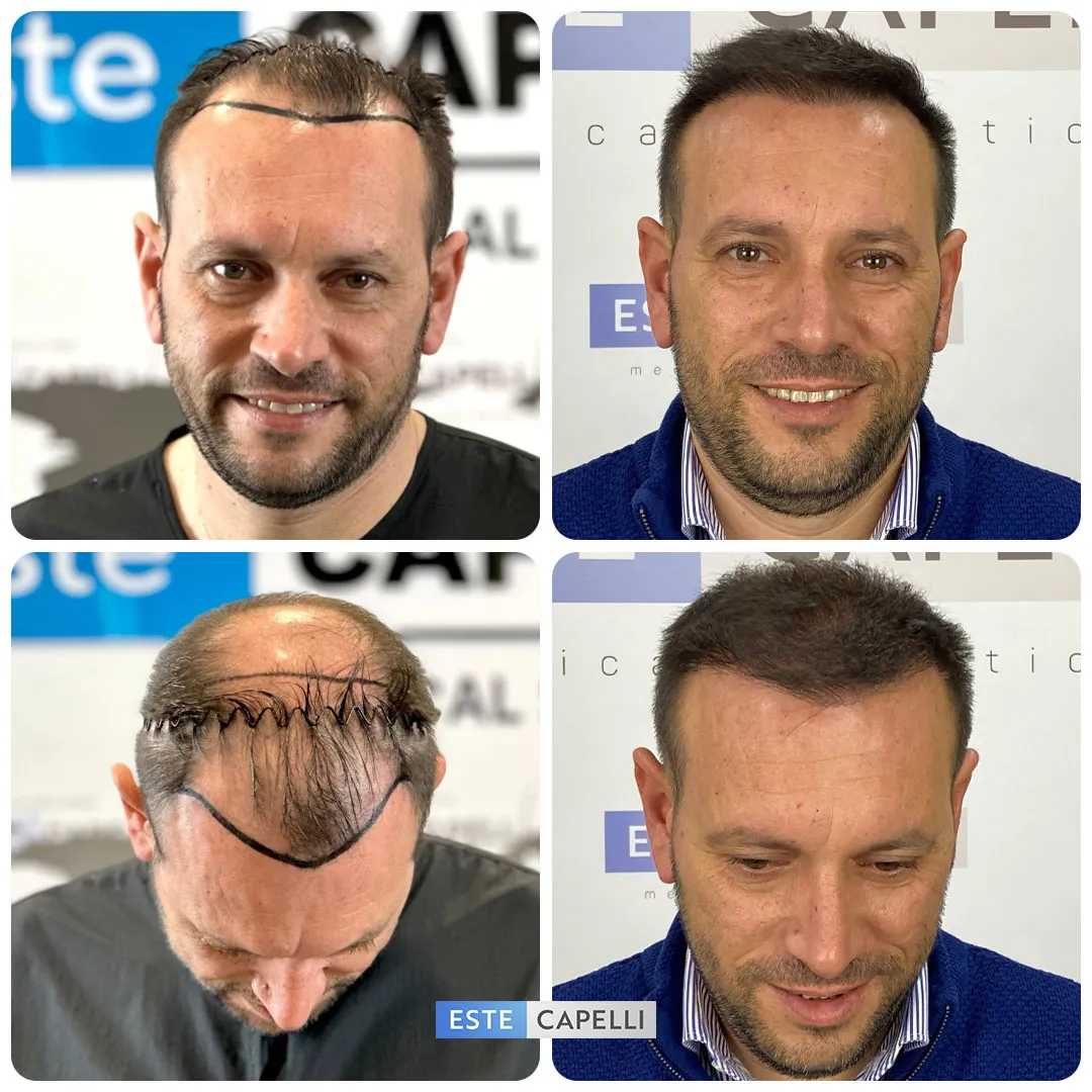 Before and after result