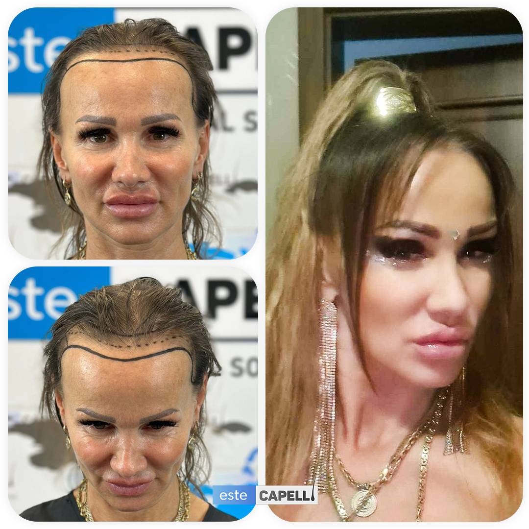 Before and after result