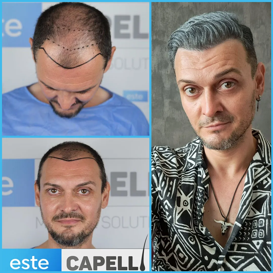 Before and after result