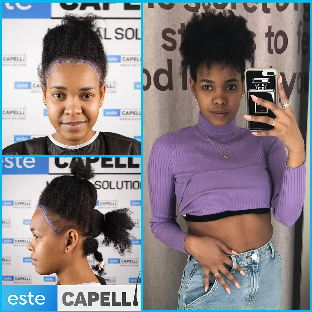 Before and after result