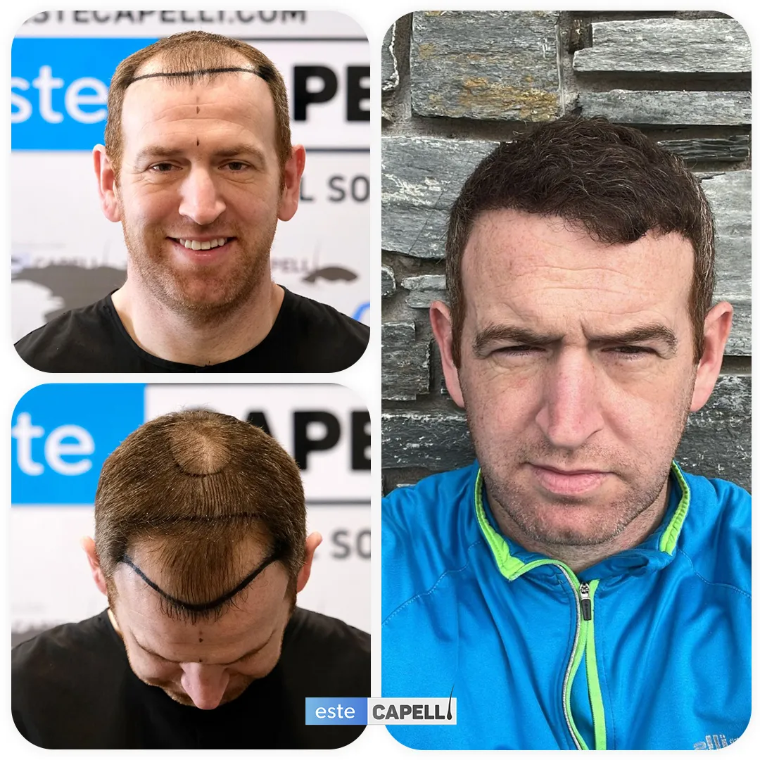 Before and after result