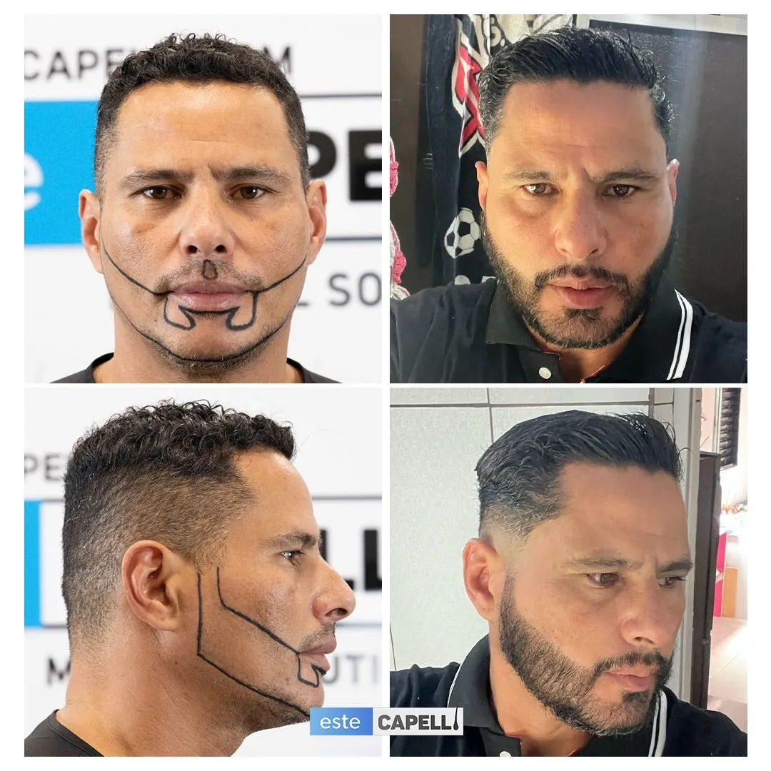 Before and after result