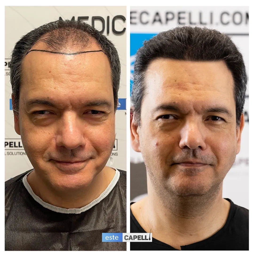 Before and after result