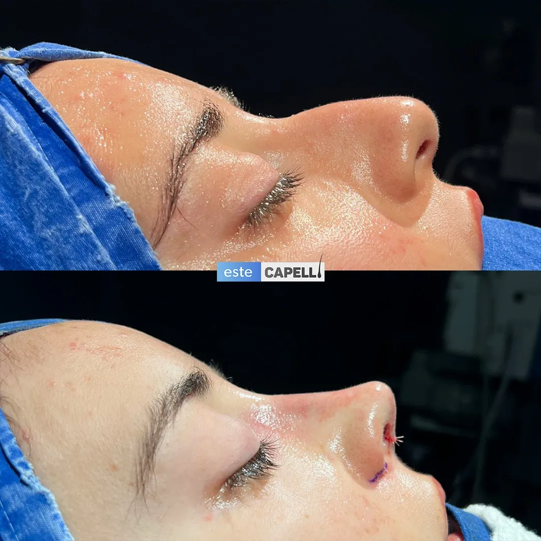 Before and after result