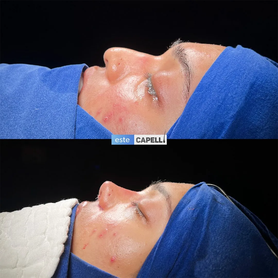 Before and after result