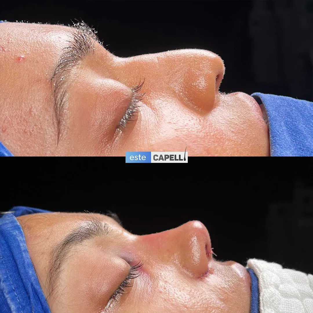 Before and after result