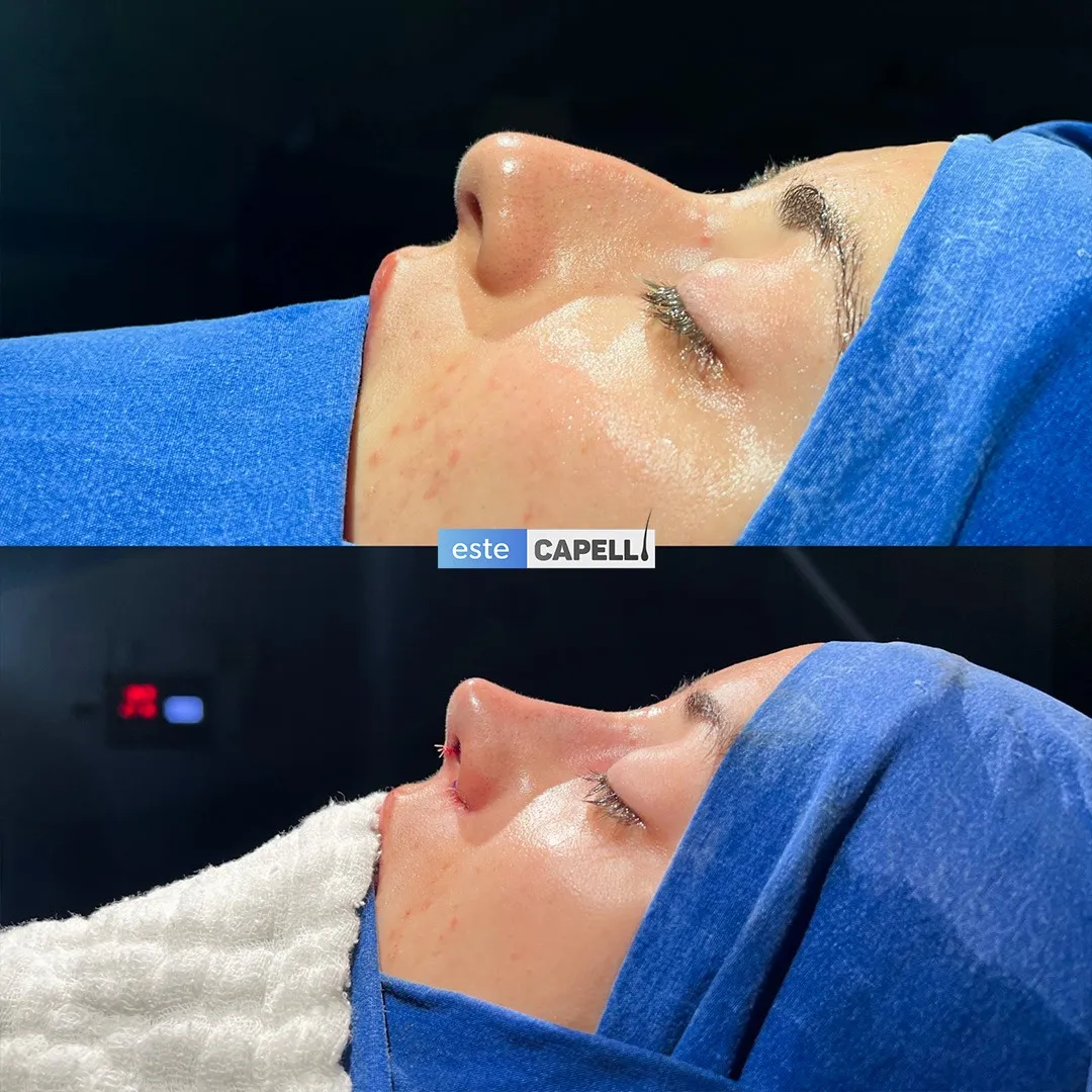 Before and after result
