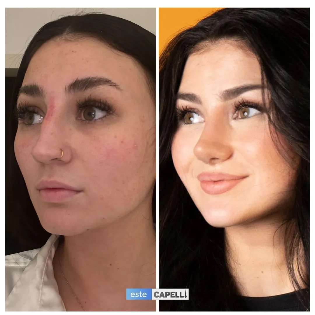 Before and after result