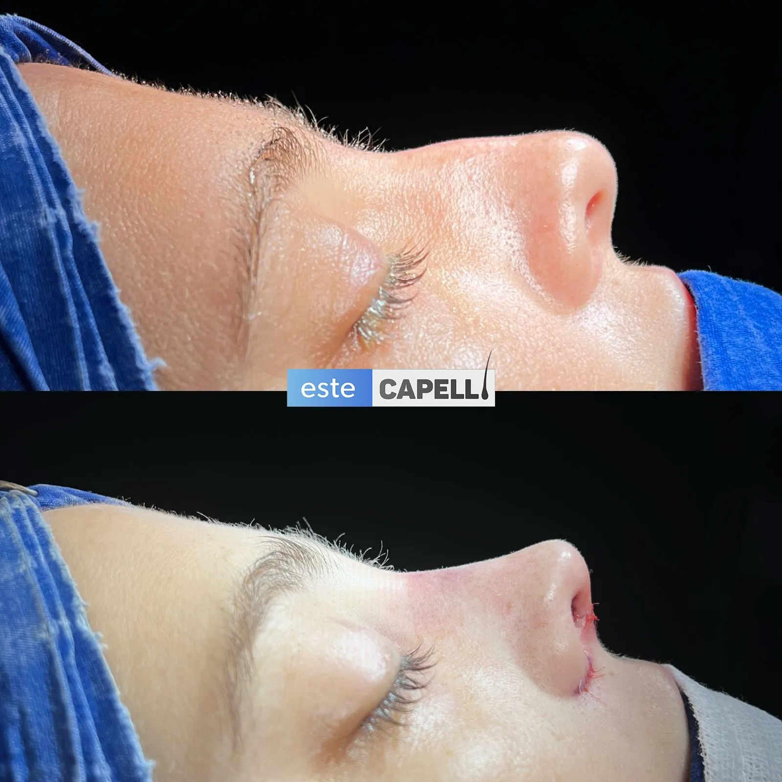Before and after result