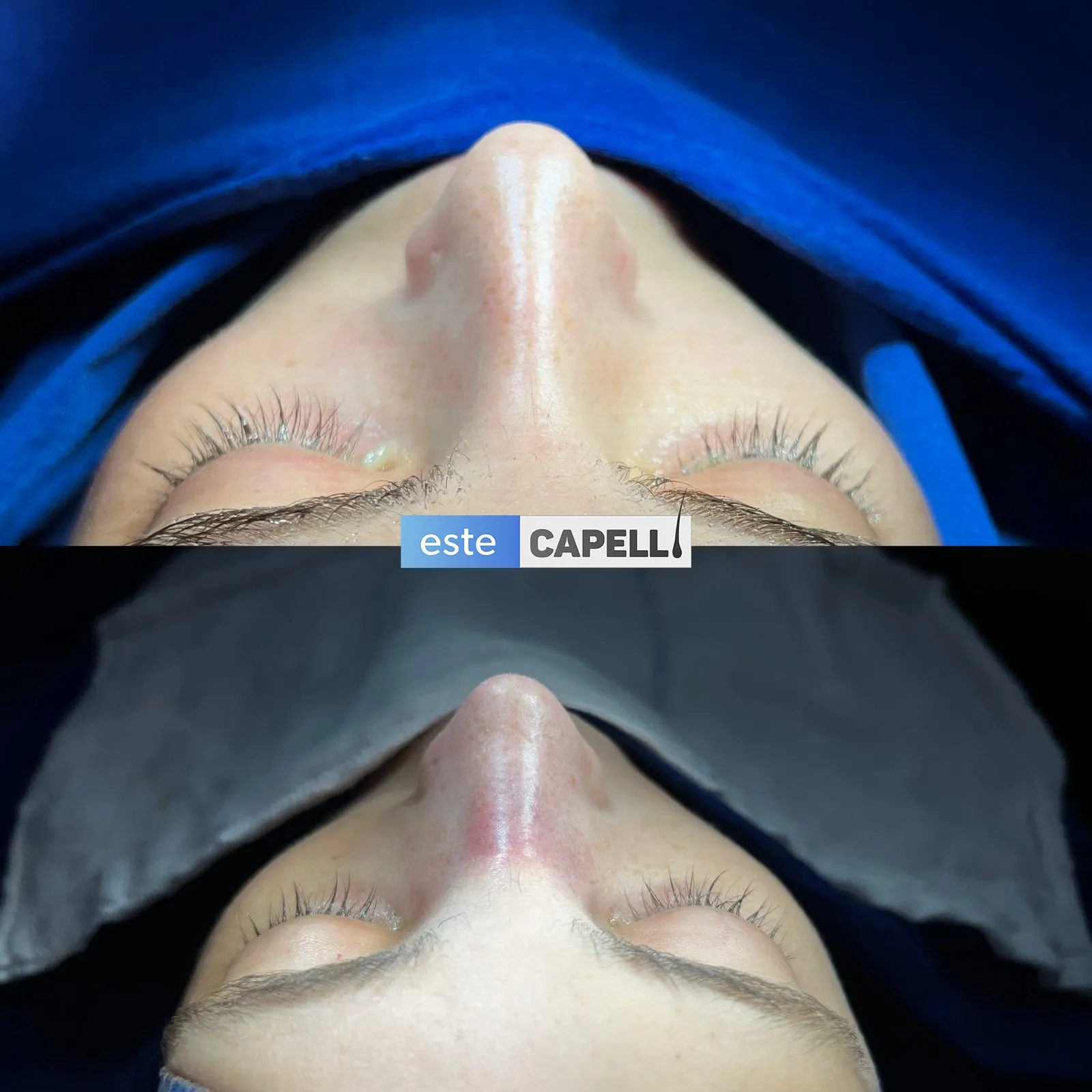 Before and after result