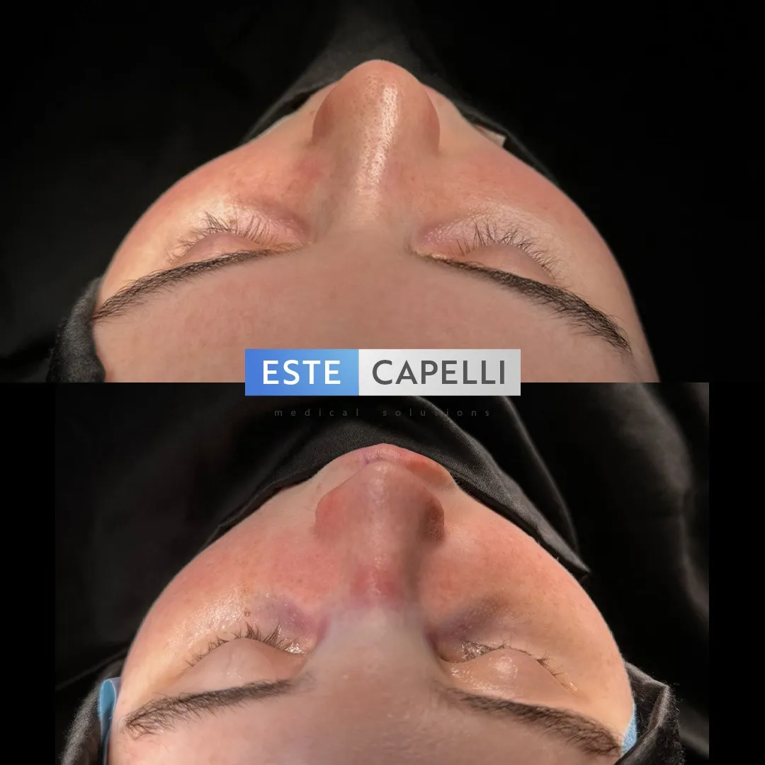 Before and after result
