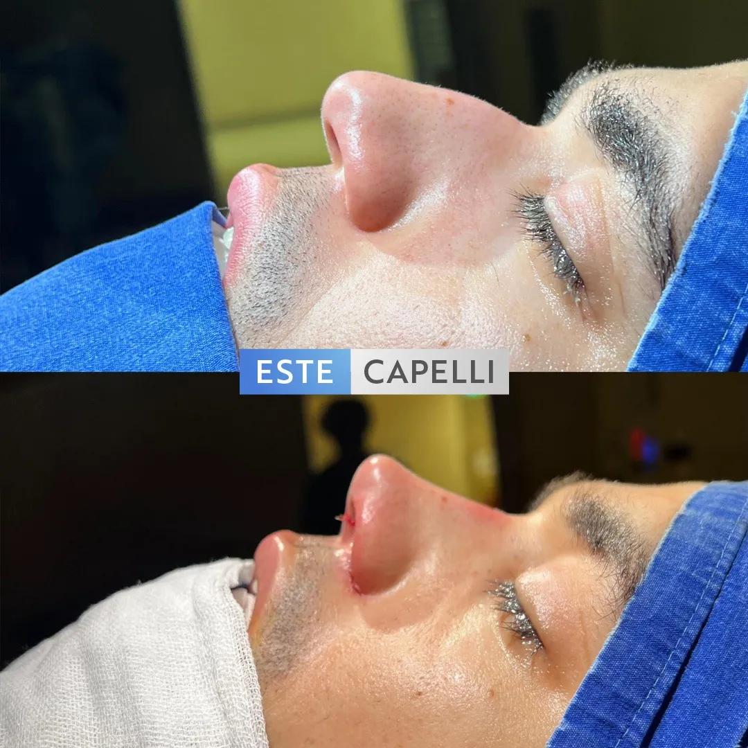 Before and after result