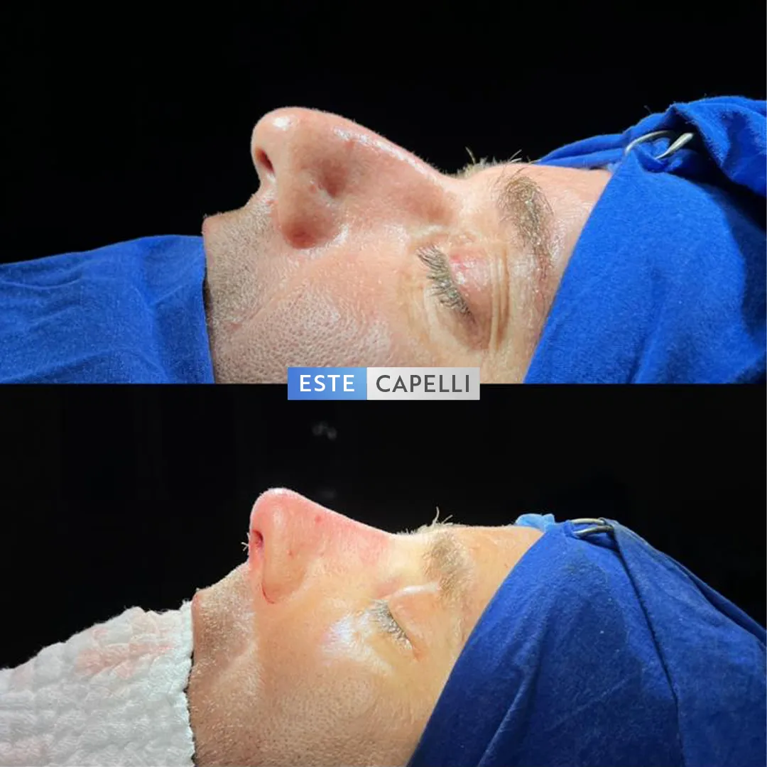 Before and after result