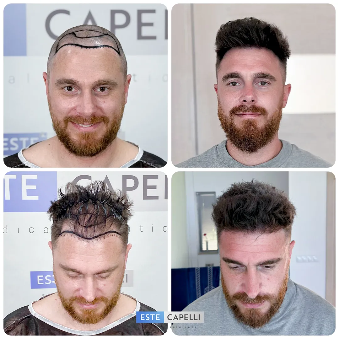 Before and after result