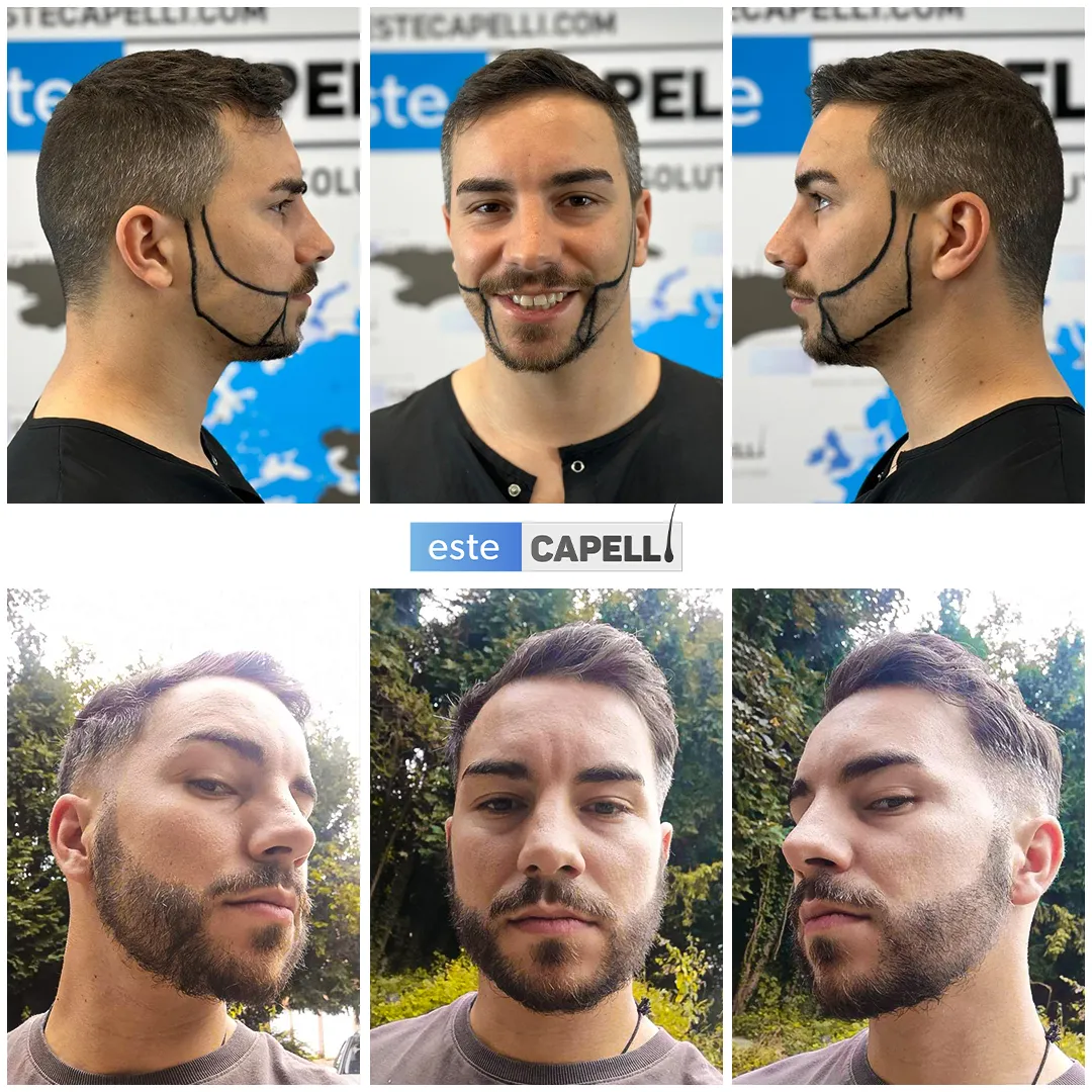 Before and after result