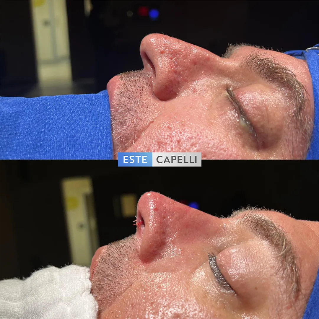 Before and after result