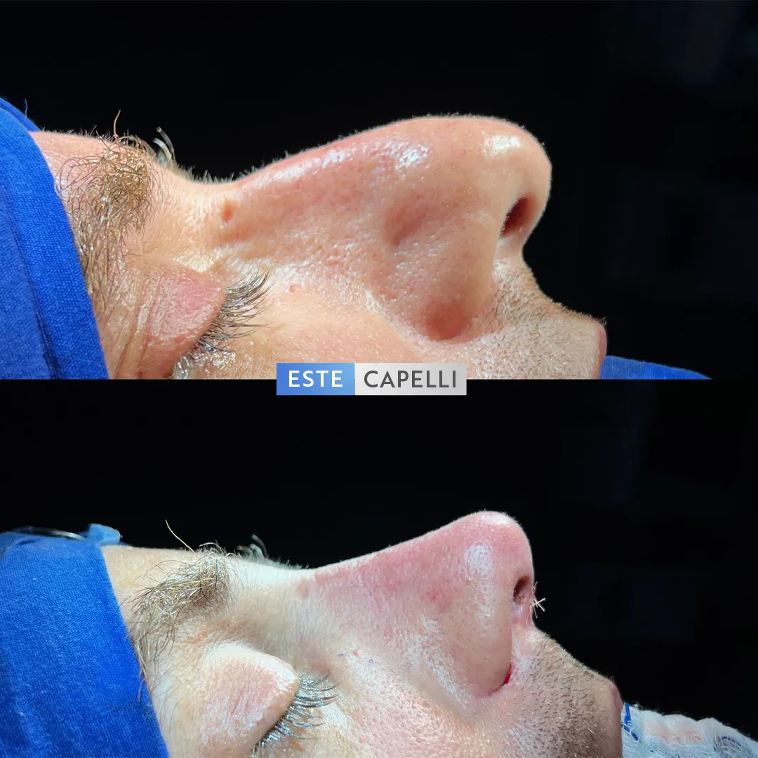 Before and after result