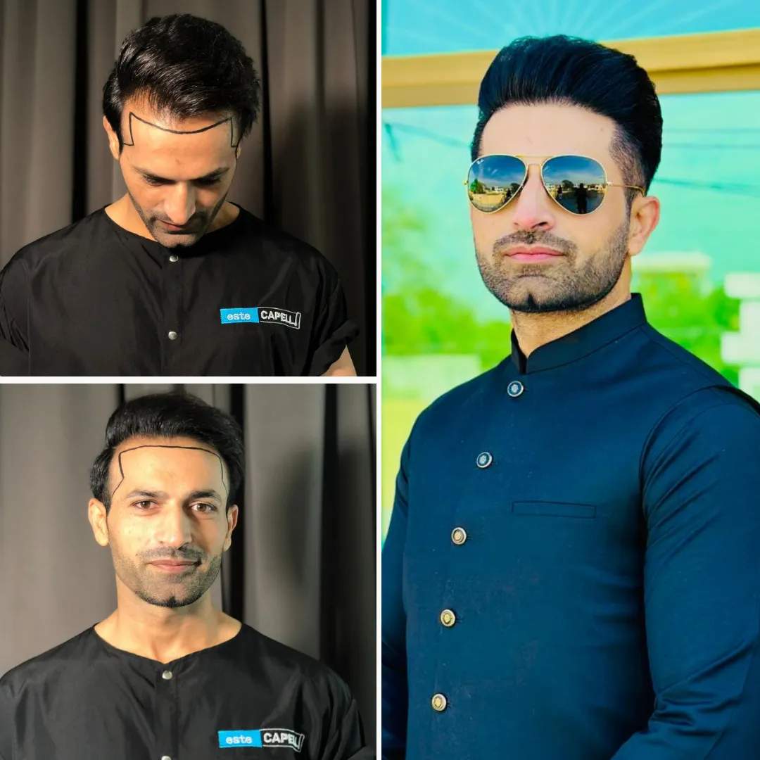 Before and after result