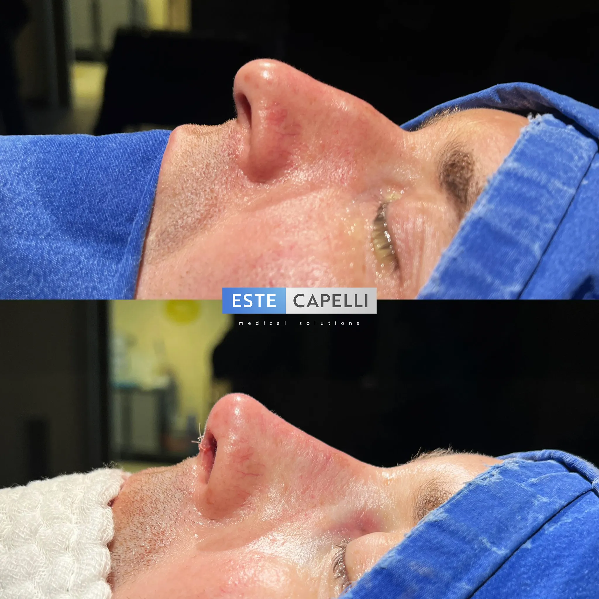 Before and after result