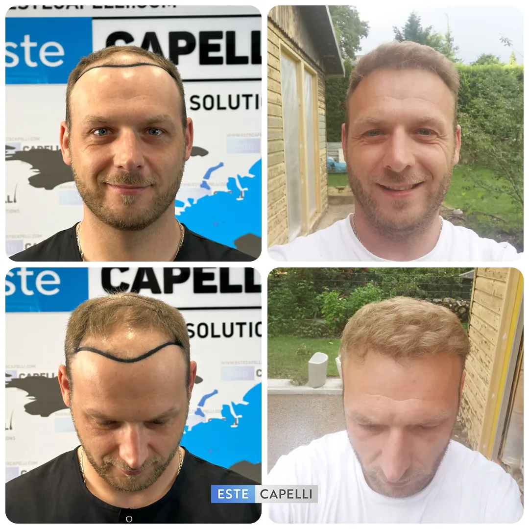 Before and after result