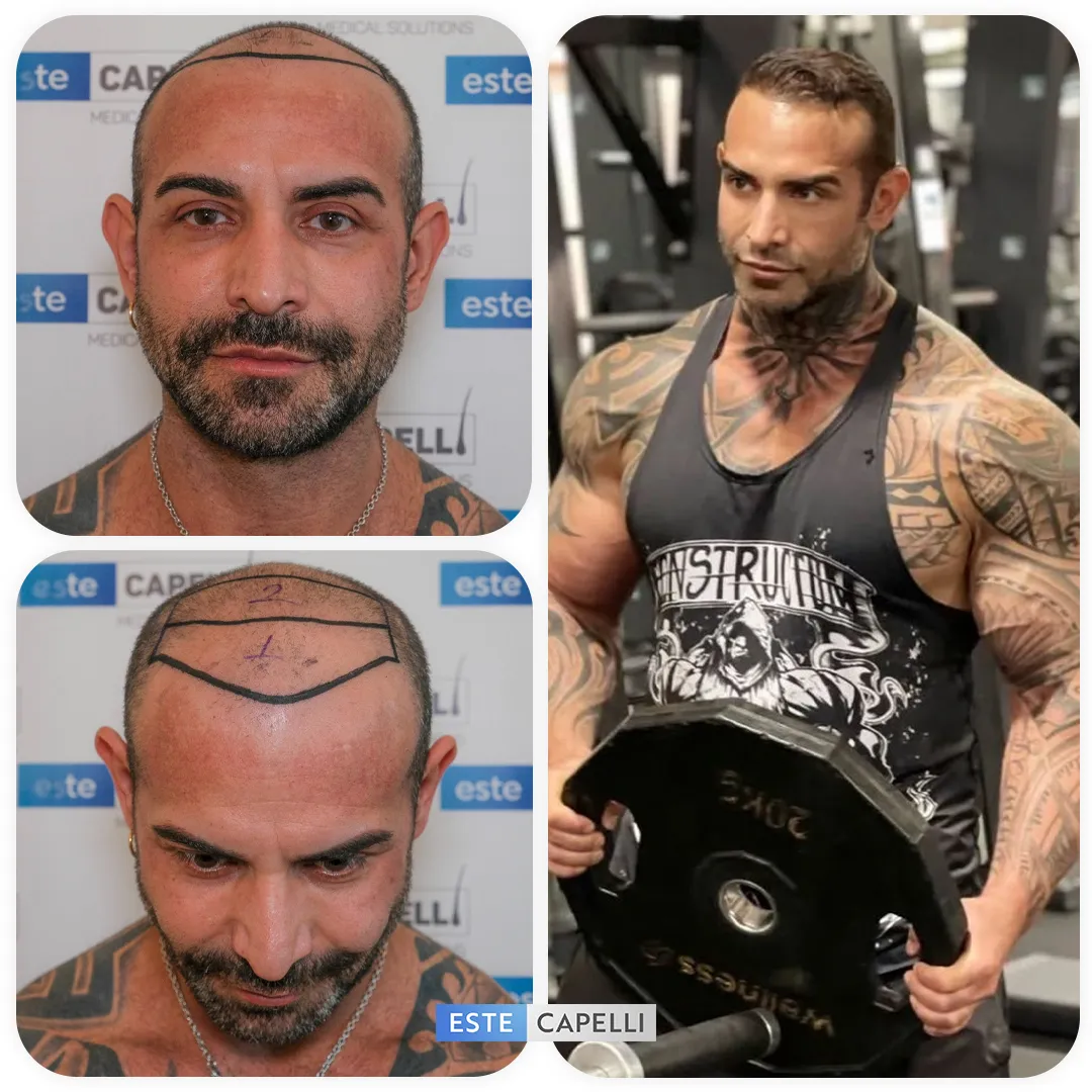 Before and after result