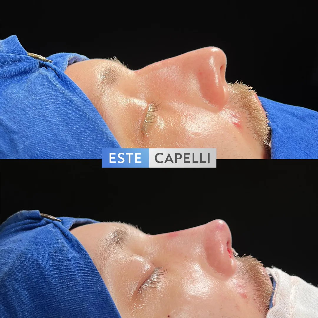 Before and after result