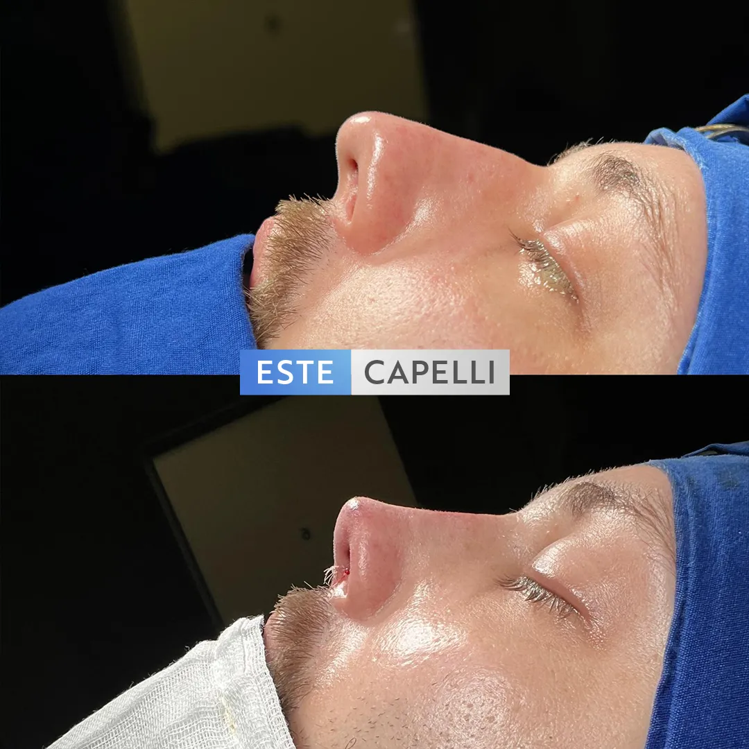 Before and after result
