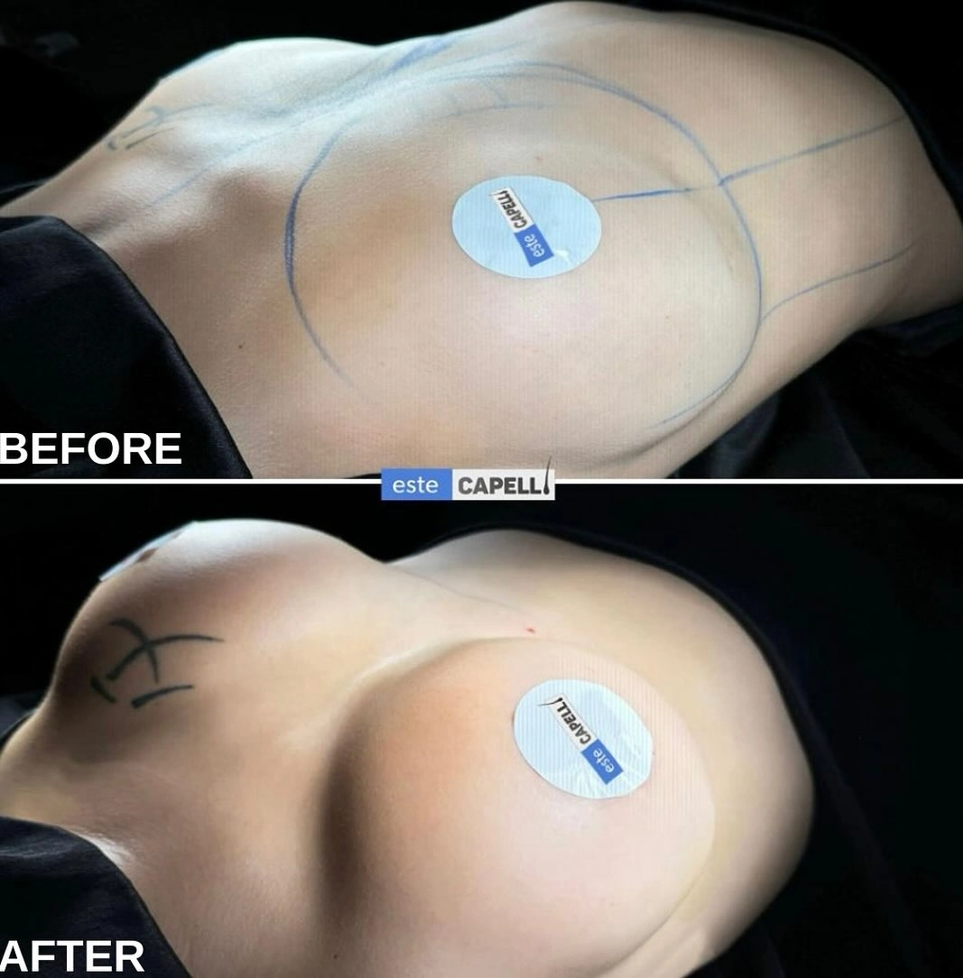 Before and after result